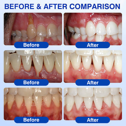 Oravelle - Daily Gum &amp; Enamel Care Gel
