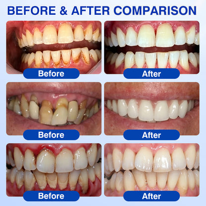 Oravelle - Daily Gum &amp; Enamel Care Gel